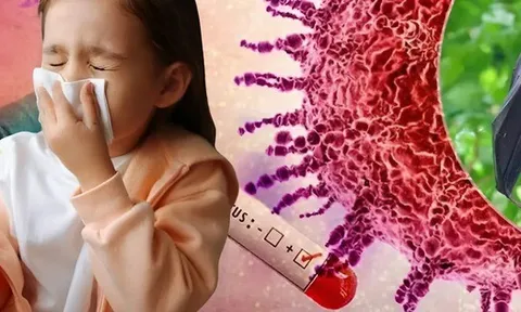 3 bệnh truyền nhiễm được Bộ Y tế bổ sung vào danh mục nhóm A - “bệnh cần giám sát chặt”: Nguy hiểm thế nào?