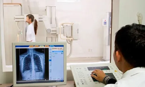 Phản ánh chụp X-quang “chờ đủ 6 phút” mới được bảo hiểm thanh toán: BHXH Việt Nam chính thức lên tiếng!