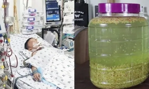 Bé 5 tháng tuổi tổn thương gan nghiêm trọng vì người lớn dùng đũa chấm vào rượu cho bé nếm thử