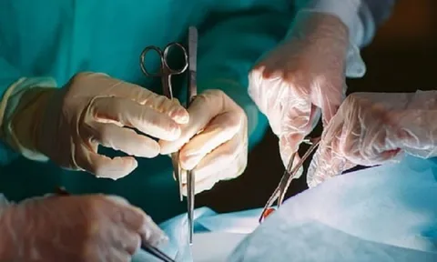 Túi thừa đại tràng 'phát nổ', bác sĩ cảnh báo biến chứng chết người