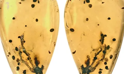 Hé lộ manh mối về nguồn gốc của bệnh u xương