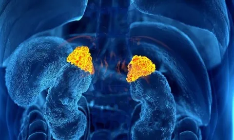 Cảnh báo hiểm họa từ loại thuốc 'uống vào là đỡ' khi đau nhức