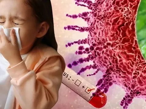 3 bệnh truyền nhiễm được Bộ Y tế bổ sung vào danh mục nhóm A - “bệnh cần giám sát chặt”: Nguy hiểm thế nào?