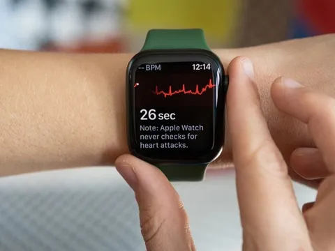 Nghiên cứu: Apple Watch phát hiện sớm nguy cơ đột quỵ tốt hơn cả khám định kỳ