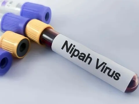 Vi rút Nipah nguy hiểm ra sao?