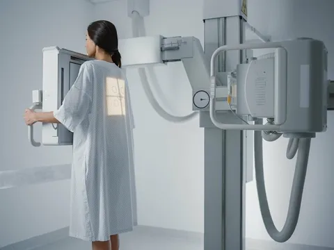Bộ Y tế: Chụp X-quang đủ 6 phút không phải căn cứ duy nhất để trả bảo hiểm y tế