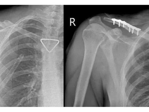 Thêm 1 du khách người Nga được bác sĩ cấp cứu kịp thời