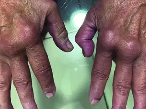 Nóng: Loại virus “phá hủy nội tạng” có thể chuẩn bị bùng phát