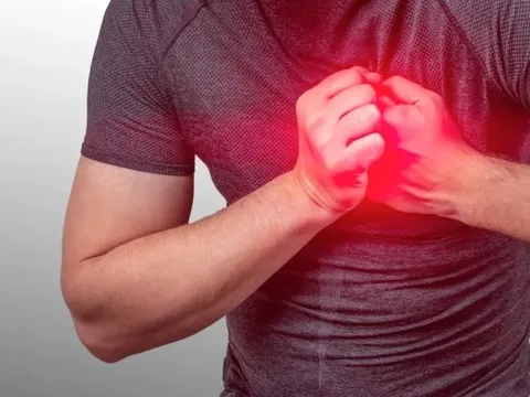 Mạch máu chính nuôi tim người đàn ông tắc tới 99%: Bác sĩ chỉ đích danh nguyên nhân