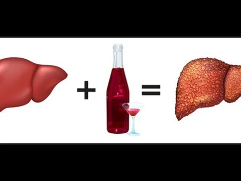 Bệnh gan tăng vọt sau Tết: Chuyên gia chỉ rõ thói quen "gánh nặng" nội tạng