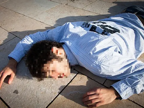 Người đàn ông 35 tuổi đột tử, bác sĩ cảnh báo 2 vùng nguy hiểm dễ bị bỏ qua