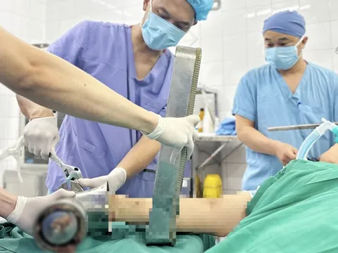 Một phút bất cẩn bên máy xay thịt, người phụ nữ trẻ phải trả giá đắt