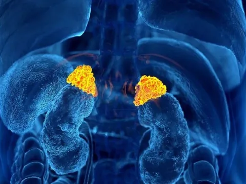 Cảnh báo hiểm họa từ loại thuốc 'uống vào là đỡ' khi đau nhức