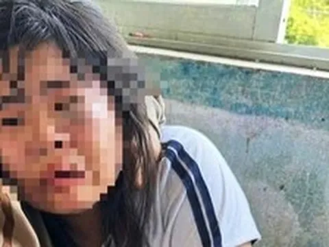 Nữ sinh lớp 7 bị 2 nam sinh lớp 9 đánh nhập viện