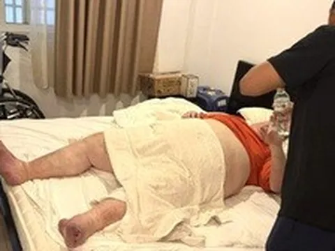 Du khách nặng gần 300 kg mắc kẹt trong nhà vệ sinh ở Đà Nẵng