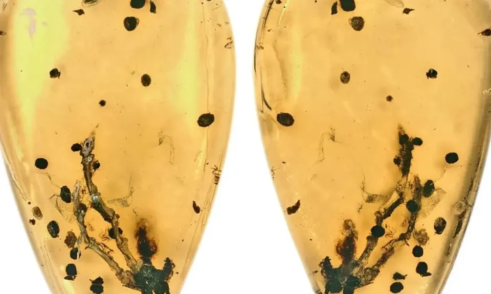 Hé lộ manh mối về nguồn gốc của bệnh u xương